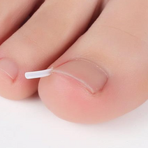 슬로우케어 내성발톱교정 테이프 10개입, 1세트