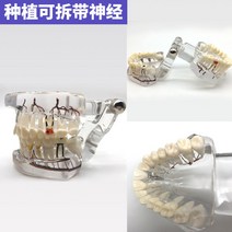 치아모형 인체모형도 치과기구 실리콘몰드 인체모형 양치교구 재료상, 임플란트 가철식 신경 치아