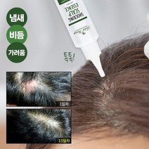 쇼킹 두피 에센스 1세트 머리 냄새 비듬 가려움 케어 관리