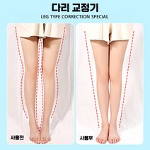 오다리 O자형 X자다리 교정기 휜다리 종아리성형, 어린이 디럭스] 발 반전+자석 2쌍