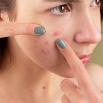 제주화산송이 세수모낭염여드름 마사지비누 모공각화증, 1개