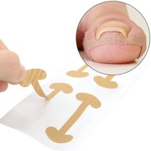 [미스릴리] 내성 발톱 보호 밴드 파고드는 발톱 완화 방지 테이프, 기본