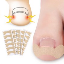 파고드는발톱 내성발톱테이프 발톱케어 교정밴드30pcs, 내성발톱교정밴드30P