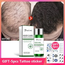 Putimi 빠른 성장 헤어 에센스 여성 남성 대머리 샴푸 모발 성장 세럼 탈모 방지 세럼 제품|Hair Loss Products|, 1개, 단일, 단일