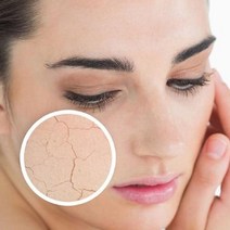 겨울철 건조한피부 튼피부 피부각질관리 수분보습크림, 아하 바하 힐링 스팀크림 100g