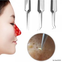 피지제거기 여드름짜기 코 얼굴 블랙헤드 압출 바늘피지제거기 짜기 코 얼굴 블랙헤드 압출 바늘, 바늘루프형