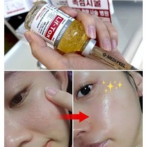﻿실리프팅 필러주름앰플 30ml/주름골 콜라겐 안티에이징 ﻿, 3)윤곽 실리프팅 주름골앰플1