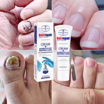 발톱 무좀약 발톱치료 연고 손톱 네일 리페어, 20ml, 3개