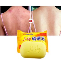 상하이 유황비누 오일 컨트롤 여드름 치료 블랙 헤드 리무버 비누 85g 화이트닝 클렌저 중국 전통 스킨 케어, 단일옵션