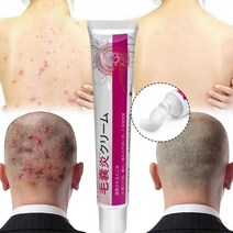 피부가려움증 모낭염 연고 지루성피부염 건선연고 여드름 습진 크림, 1개, 20g