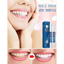 치아미백 젤 치아 누런 때 제거 브라이트닝 젤펜 치아 누런때 제거 (19g*2개/박스)*1/3, 박스(19g*2개/박스)*3