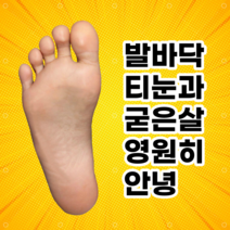 CB40 티눈깔창 발바닥 굳은살 제거, 265~270, 블루 혹은 그레이 랜덤
