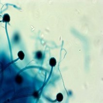 누룩곰팡이 슬라이드