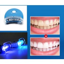불소도포 치아미백기계 누런이빨 누런이 셀프 화이트닝 간단한 홈케어 미백제 착색제거제, 5 PC 빛