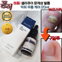 [공식] 리뉴얼 닥터로운 셀라큐어 20mI 문제성 발톱 무좀 관리 셀라솔루션 닥터로운셀라큐어 문제성발톱 티트리 뉴리트리언트 믹스, 1개, 2개입