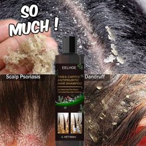 100ml 샴푸 안티-비듬 가려움증 및 Flaking 두피 건선 지루 피부염, 01 100ml shampoo 1pc
