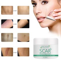 Bestevery 상처 스트레치 마크 제왕 절개에서 오래된 흉터와 새로운 흉터를 위한 30ml 흉터 제거 크림, 1개