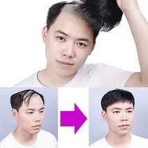 정수리 탈모가발 붙임머리피스 붙임머리 남자 머리숱 남자앞머리가발 원형 붙임가발 가발, 0해당없음