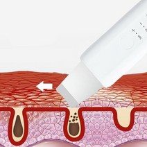 워터 아쿠아 필링기 얼굴각질제거기, 아쿠아필링기