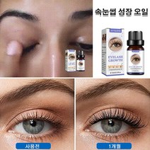 속눈썹 성장 세럼 흔적없이 가늘고 길어지는 속눈썹 세럼 속눈썹 영양제 10ml*2/4/6, (가늘고 길어지는 속눈썹 세럼 10ml)x4