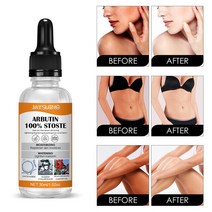 알부틴 스킨 브라이트닝 에센스 액체 화이트닝 라이트닝 세럼 캐스터 오일 제거 Chloasma 표백 크림 30ml, [01] 30ml