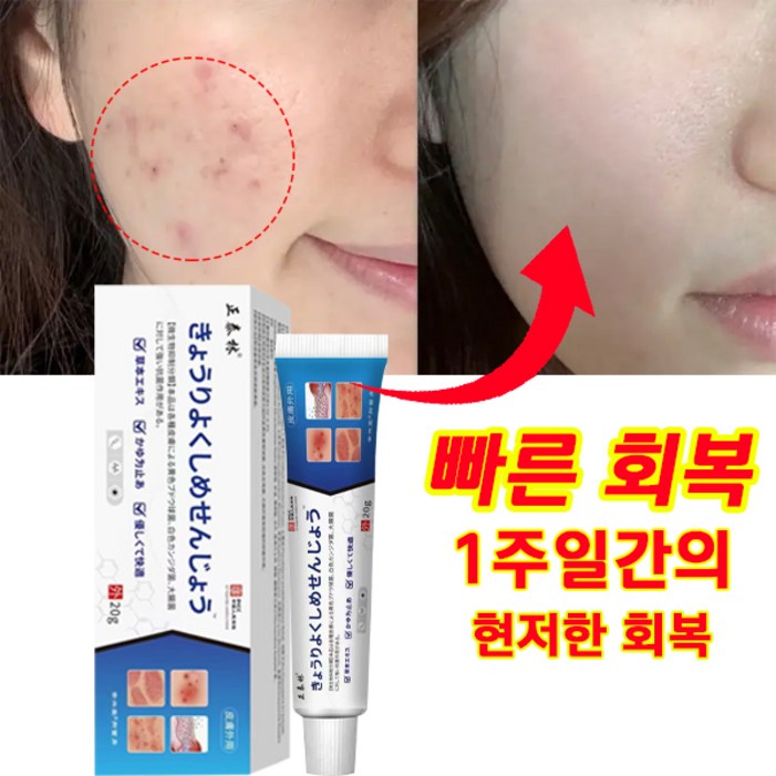 일본 히트 상품당일배송 여드름 흉터 색소침착 제거 여드름 민감피부 개선 모공 진정 피지케어 크림