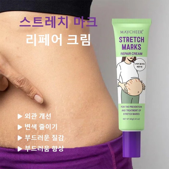 튼살제거 임산부 전용 출산 후 뱃살 탱탱 튼살 완화 크림 흉터 비만 주름 탄력 케어 크림 바디케어, 5개, 40g