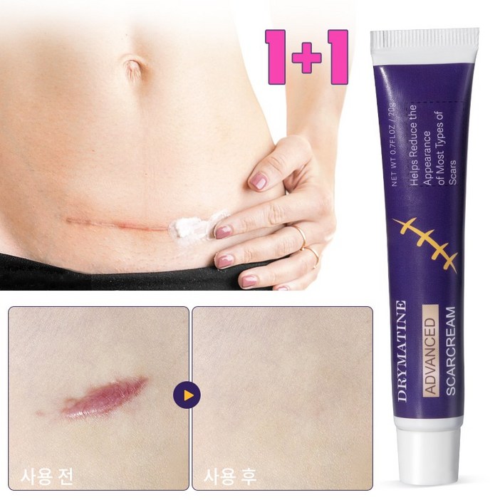 [당일배송] DRYMATINE 흉터연고 흉터제거연고 재생크림 상처흉터연고 여드름흉터 수술흉터 화상물집 흉터제거연고 20g, 20ml, 2개