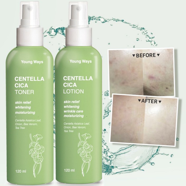 영웨이즈 시카 토너 120ml  로션 120ml 세트  티트리  병풀  봉독  어성초 여드름