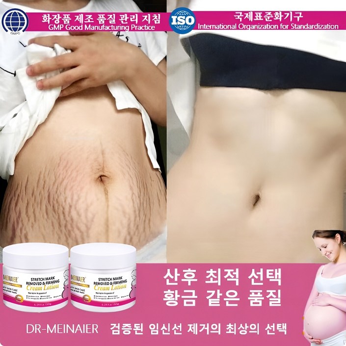 임신 크림 Stretch Mark Cream 임신부 바디 로션 산후 크림, 1개, 150g