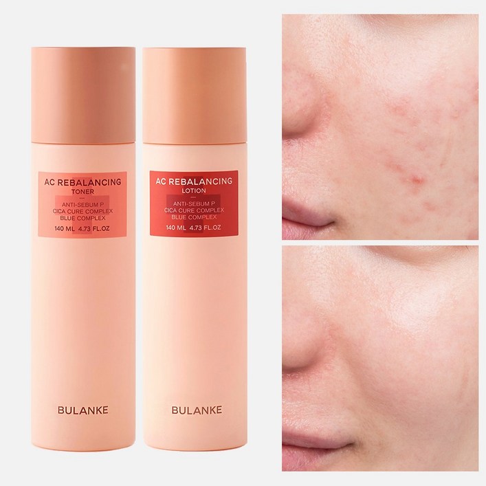 불란케 에이씨 리밸런싱 2종세트, 1세트