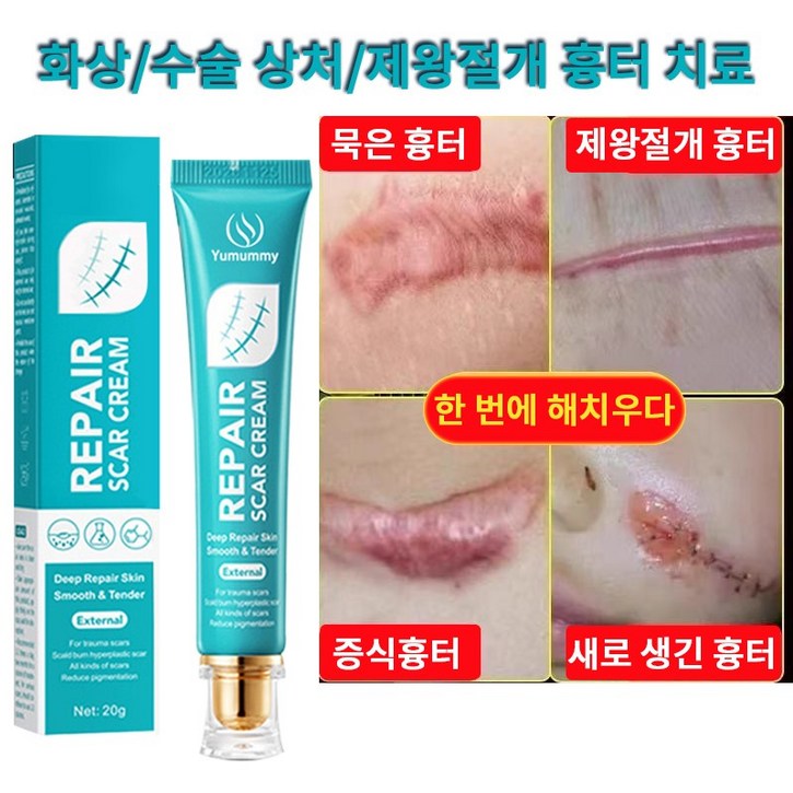 흉터 연고 피부 흉터 복구 및 개선, 1개, 20ml