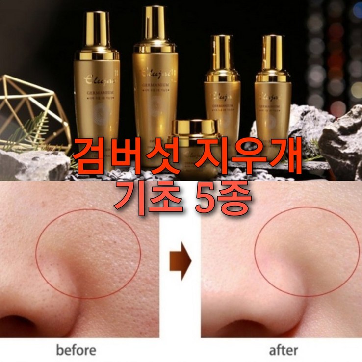 검버섯지우게 5종 세트고흡수 아데노신 기능성스킨케어, 1세트