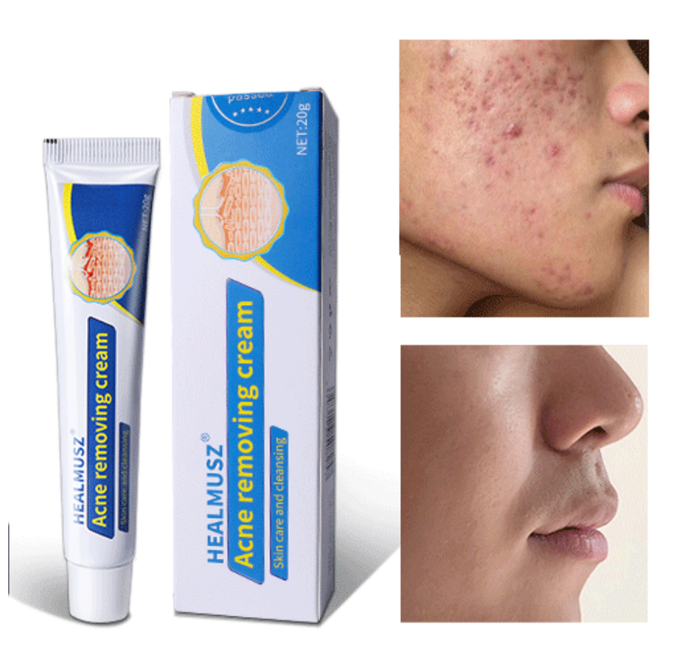 당일배송 여드름 연고 여드름 치료 스킨 배리어 리커버리 수부지 관리 크림, 1개, 20ml